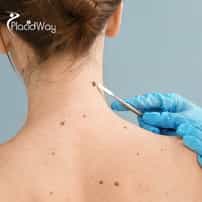 Advanced Melanoma Treatment in Tijuana - Targeting Metastasis When Standard Care Fails